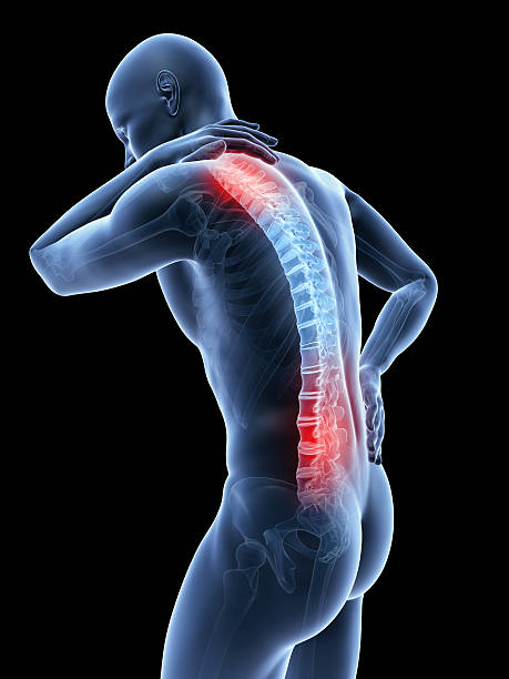 3d rendered illustration of a man having backache